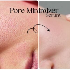Pore Minimizer Serum - ত্বকের oil production কমিয়ে দেয় এবং মুখের ছোট-বড় গর্তগুলোকে (pores) সংকুচিত করে ত্বককে smooth এবং উজ্জ্বল করে।